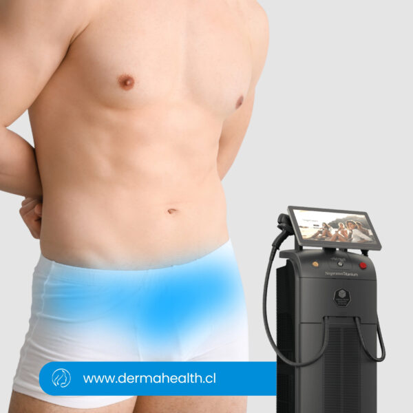 DEPILACIÓN LÁSER SOPRANO TITANIUM - Rebaje hombre - 6 SESIONES