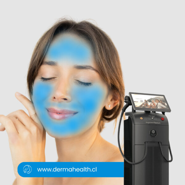 DEPILACIÓN LÁSER SOPRANO TITANIUM - Rostro - 6 SESIONES