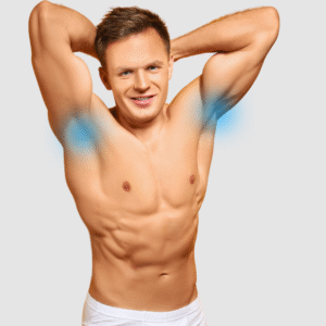 DEPILACIÓN LÁSER SOPRANO TITANIUM - Axilas Hombre - 6 SESIONES