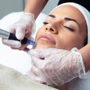Plasma facial con vitaminas y dermapen