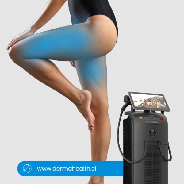 DEPILACIÓN LÁSER SOPRANO TITANIUM - Muslo - 6 SESIONES
