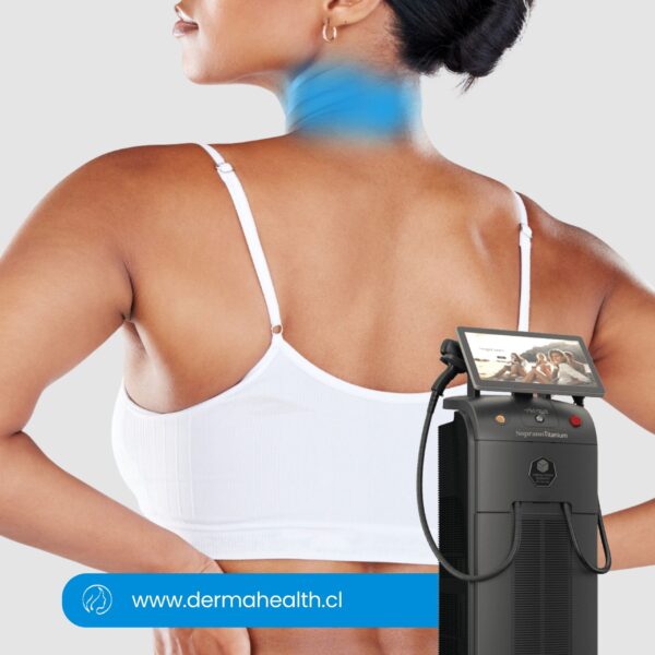 DEPILACIÓN LÁSER SOPRANO TITANIUM - Cuello anterior - 6 SESIONES