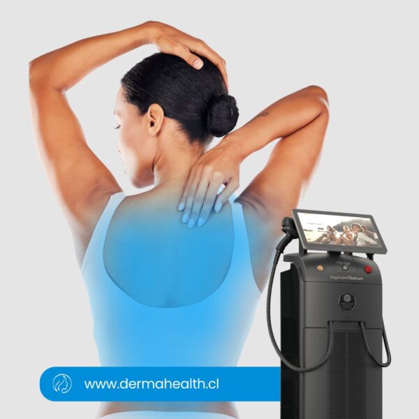 DEPILACIÓN LÁSER SOPRANO TITANIUM - Espalda mujer - 6 SESIONES