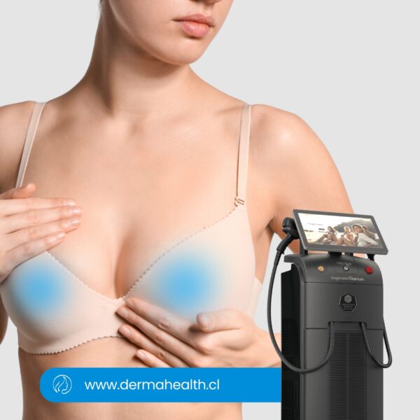 DEPILACIÓN LÁSER SOPRANO TITANIUM - Areola - 6 SESIONES