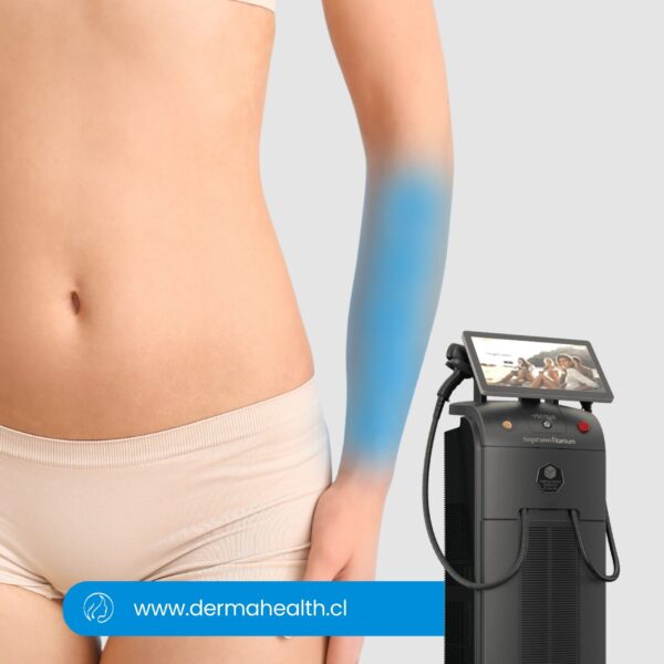 DEPILACIÓN LÁSER SOPRANO TITANIUM - Antebrazo - 6 SESIONES