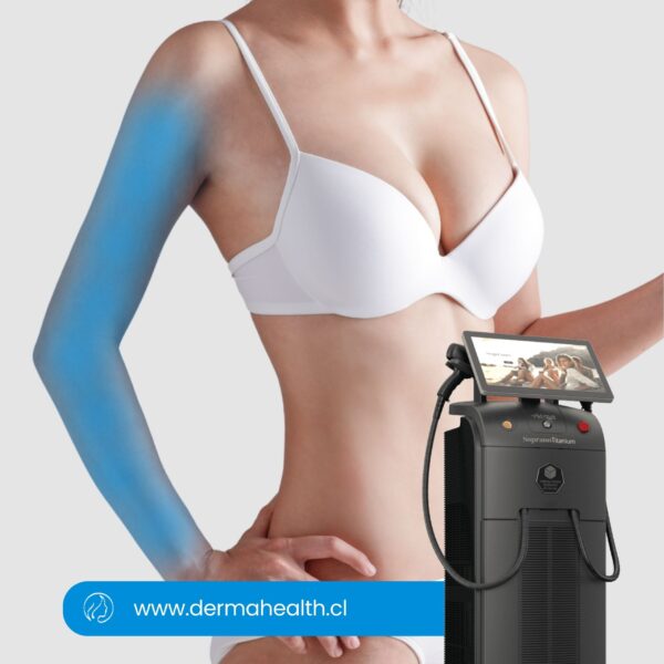 DEPILACIÓN LÁSER SOPRANO TITANIUM - Brazo completo - 6 SESIONES