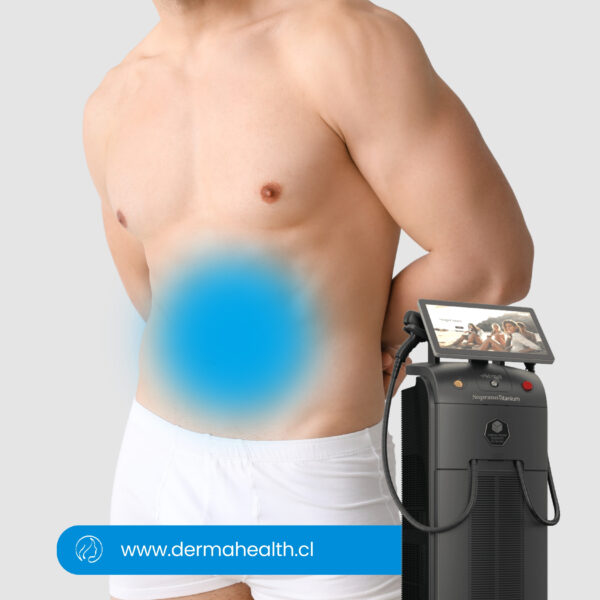 DEPILACIÓN LÁSER SOPRANO TITANIUM - Abdomen - Hombre  - 6 SESIONES