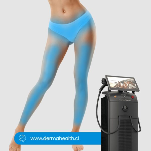 DEPILACIÓN LÁSER SOPRANO TITANIUM - Rebaje completo y pierna completa - 6 SESIONES