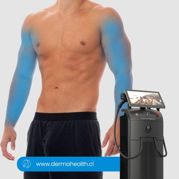 DEPILACIÓN LÁSER SOPRANO TITANIUM - Brazos completos hombre- 6 SESIONES