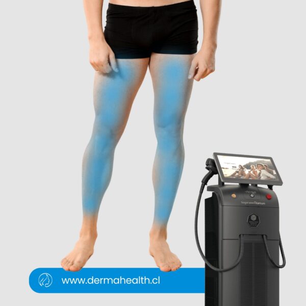 DEPILACIÓN LÁSER SOPRANO TITANIUM - Piernas completas  Hombre - 6 SESIONES