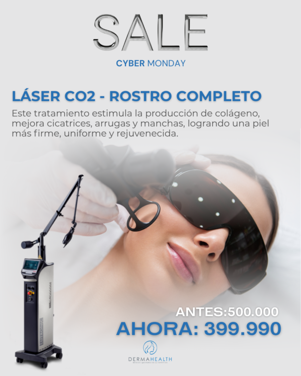 LÁSER CO2 - ROSTRO COMPLETO
