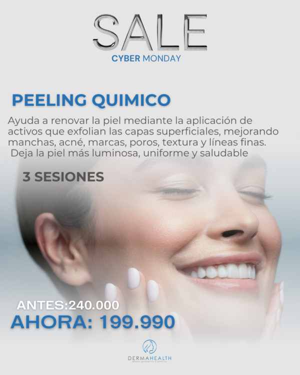 PEELING QUIMICO