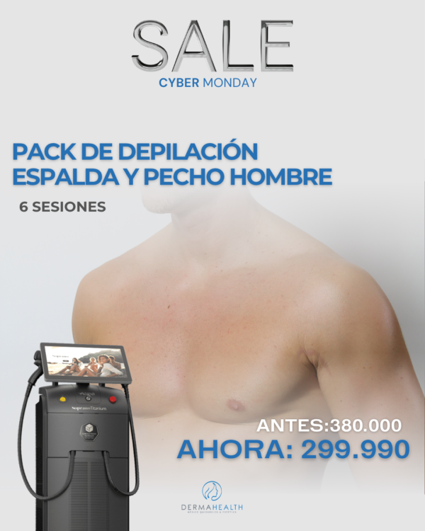 DEPILACIÓN LÁSER SOPRANO TITANIUM - ESPALDA Y PECHO HOMBRE - 6 SESIONES