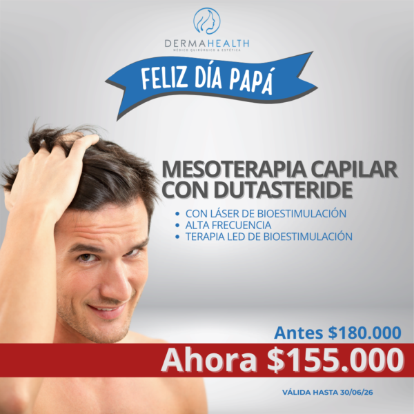 MESOTERAPIA CAPILAR CON DUTASTERIDE