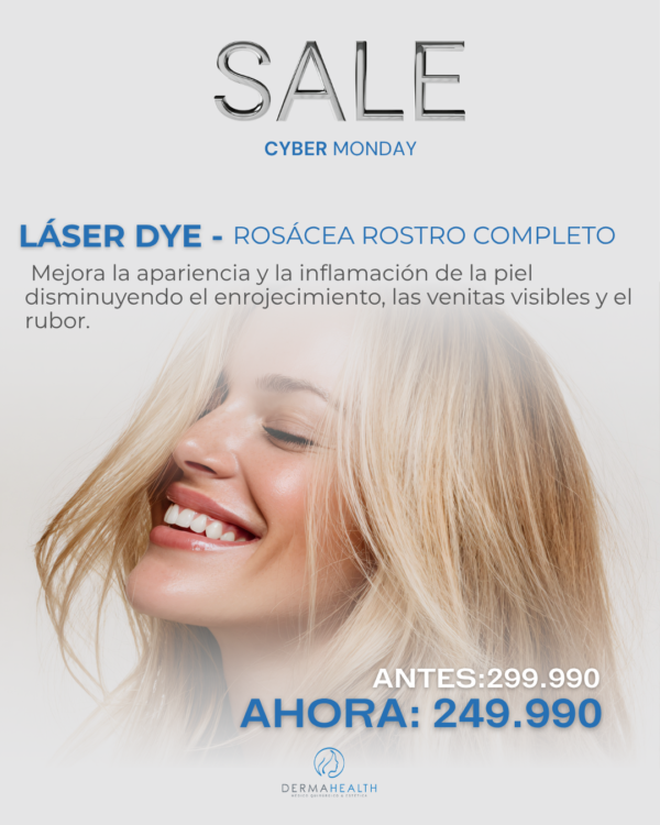 LÁSER DYE - ROSÁCEA ROSTRO COMPLETO
